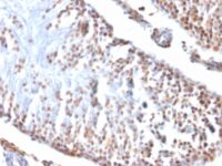 Formalin-fixed, paraffin embedded rat testis sections stained with 100 ul anti-Wilms Tumor 1 (clone 6F-H2) at 1:100. HIER epitope retrieval prior to staining was performed in 10mM Citrate, pH 6.0.